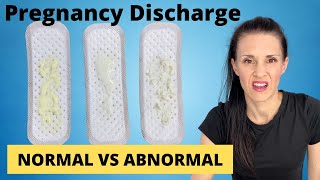 Pregnancy Discharge | Vaginal Discharge During Pregnancy | WHAT TO KNOW