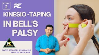 KINESIO-TAPING TECHNIQUES FOR BELL'S PALSY PATIENT : LEARN TAPING TO RECOVER FACIAL MOVEMENTS