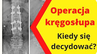 Rwa kulszowa i dyskopatia - kiedy konieczna jest operacja kręgosłupa lędźwiowego?