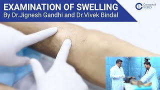 Examination of Swelling By Dr. Jignesh Gandhi and Dr. Vivek Bindal