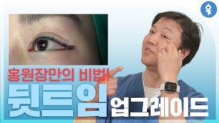 부작용❌ 뒷트임? 최신 업그레이드!!