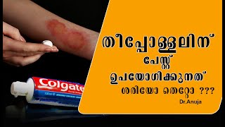 തീപ്പൊള്ളലിനു  പേസ്റ്റ്  പുരട്ടാമോ ?|appliacation of paste in burn is good or bad?|dr.anuja|