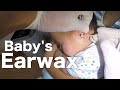 2 Month Old Baby's Ear Cleaning | Look ! What's Removed From Baby's Ear