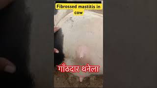 Fibrosis mastitis l Dr umar khan