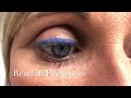 eye prosthesis neo iris technology realistic prosthetic eye