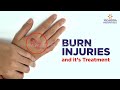 Different Types of Burn Injuries and Treatment | Plastic Surgeon in Hyderabad | Yashoda Hospitals