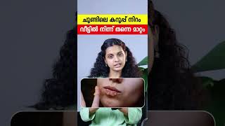 ചുണ്ടിലെ കറുപ്പ് നിറം വീട്ടിൽ നിന്ന് തന്നെ മാറ്റാം|