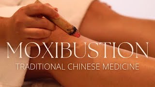 Moxibustion (Moxa) 101: Simple Steps for Beginners