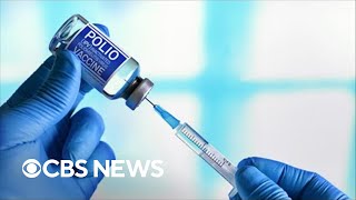 Polio vaccine inventor's son on resurgence of virus in U.S.
