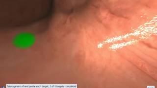 EndoSim Upper GI: Photo and probing