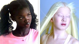 20 Rare Teens That Are One in a Million