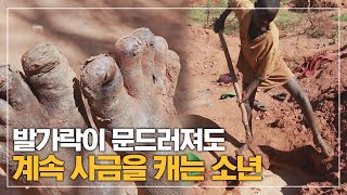 발가락에 물벼룩이 생겨 문드러져도 가족을 책임지기 위해 사금을 열심히 캐는 소년