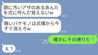 【LINE】尊敬する兄の結婚式で生まれつき顔にアザのある私を化け物扱いする兄嫁「醜いお前は今すぐ帰れw」兄「確かにその通りだ」→兄の一言で兄嫁は何もかも失う羽目にwww