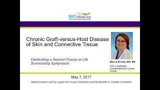Chronic Graft versus Host Disease of Skin and Connective Tissue 2017