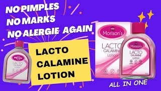 Morison Lacto Calemine Lotion ❤ / කුරුලෑ, දාඩිය බිබිලි වලට තිත.