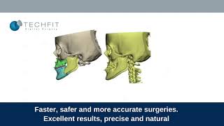 Orthognathic digital Planning solution - Techfit Digital Surgery