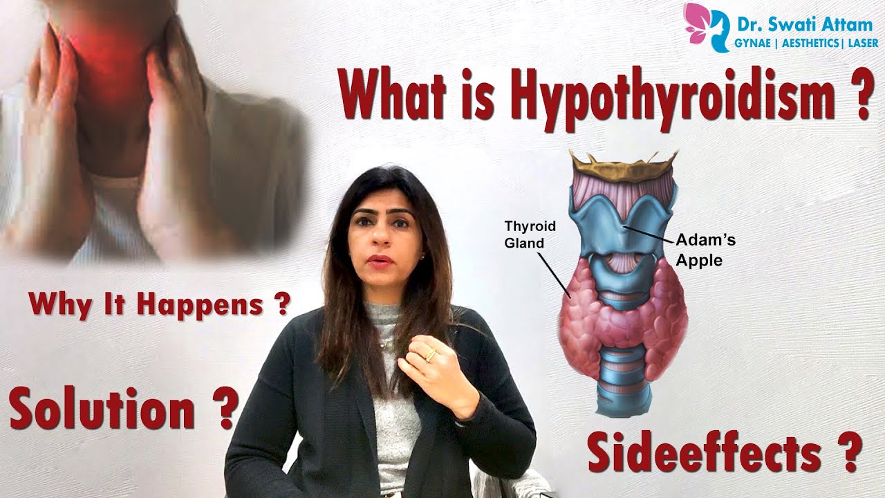 Hypothyroidism (Underactive Thyroid) Symptoms, Causes ... - YouTube