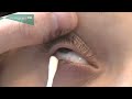 how to clean the eyelids in children and babies