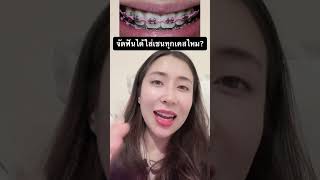 จัดฟันได้ใส่เชนทุกคนไหม? #หมอณัฐคุณ #คลินิกทันตกรรมทูธลักค์ #toothluck #จัดฟัน #ทำฟันขอนแก่น