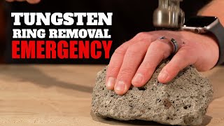 How to Remove a Tungsten Ring in an Emergency