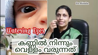 കണ്ണിൽ നിന്നും വെള്ളം വരുന്ന രോഗാവസ്ഥ/Watering Eyes/Babycare tips Dr Bindu