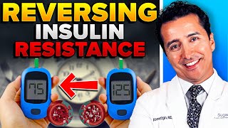 If You Do This Your Insulin Resistance Will Be Normal In 2 Weeks!