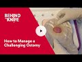 Behind the Knife - How to Manage a Challenging Ostomy