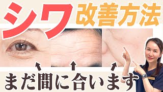 【シワ改善】できてしまったシワの治療方法を美容皮膚科医が解説！