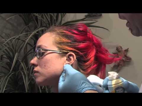 How to Treat Ear Piercing Infections How to Treat Ear Piercing Infections