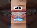 3 braces colors to avoid #shorts #bracescolors #teeth