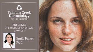 Are freckles a sign of sun damage?