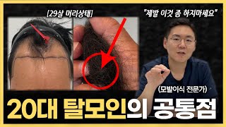 20대에 탈모에 걸리는 사람들의 4가지 실수 l 이 행동하면 100% 탈모옵니다