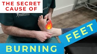 The Secret Cause of Chronic **BURNING FEET** (Can't Catch Dr. Chris??) \u0026 How to Fix