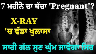 7 ਮਹੀਨੇ ਦਾ ਬੱਚਾ 'Pregnant' ? X-RAY 'ਚ ਵੱਡਾ ਖੁਲਾਸਾ, ਸਾਰੀ ਗੱਲ ਸੁਣ ਘੁੰਮ ਜਾਵੇਗਾ ਸਿਰ | Gabruu | Shocking