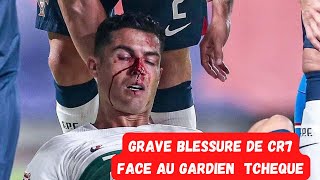 Graves blessure de Cristiano Ronaldo face au Gardien gardien Tchèque ...