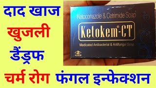 Ketokem-CT Soap uses in hindi | Ketoconazole | Ketokem soap | K2 Soap | Keto soap