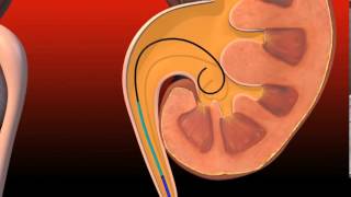 Cook Medical Urology:  Resonance®