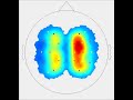 nirx nirslab analysis software total hemoglobin dynamic visualization