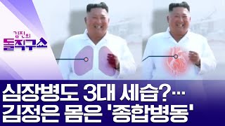 심장병도 3대 세습?…김정은 몸은 ‘종합병동’ | 김진의 돌직구 쇼 465 회