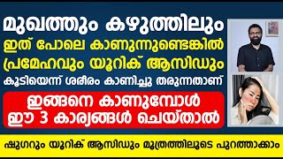 ഈ 3 കാര്യങ്ങൾ ചെയ്താൽ ഷുഗറും യൂറിക് ആസിഡും മൂത്രത്തിലൂടെ പുറത്താക്കാം | Uric acid malayalam