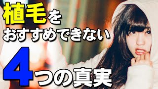 【後悔しないために】自毛植毛をオススメできない4つの理由 費用,成功率etc. 懸念点を徹底解説！