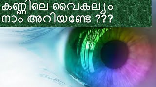 കണ്ണിലെ വൈകല്യം നാം അറിയണ്ടേ ???| |eye defects |  |