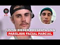 Justin Bieber cuenta que presenta una parálisis facial en un lado de su rostro | El Espectador