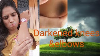 మోచేతులు,మోకాళ్లు నల్లగా..ఉన్నాయా?Darkened Knees\u0026Elbows Effective best home remedies..