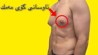 گاینیکۆماستیا Gynecomastia چییە؟