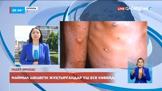 Еуропада маймыл шешегін жұқтырғандар 3 есе көбейді