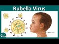 Rubella | German Measles | Rubella virus | pathogenesis, diagnosis and treatment of Rubella