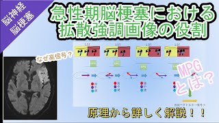 急性期脳梗塞における拡散強調画像の役割