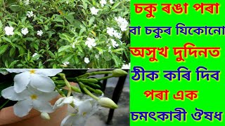 2 দিনত চকু ৰঙা পৰা বা চকুৰ যিকোনো অসুখ ভাল কৰা চমৎকাৰী ঔষধ ||Benefits of single jesmeen ||