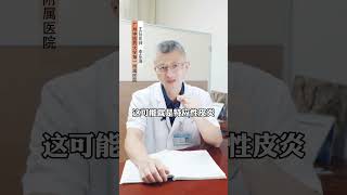 皮肤干燥，剧烈瘙痒，骚抓后，痂痕累累，#特应性皮炎 这样治#皮肤 #瘙痒